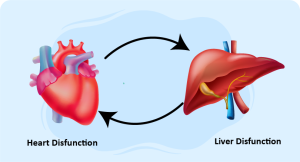 heart and liver disfunction illustrating congestive hepatopathy treatment
