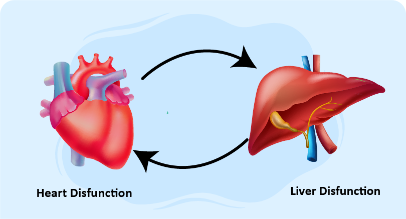 heart and liver disfunction illustrating congestive hepatopathy treatment