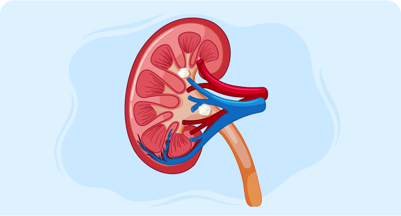 Kidney cysts guide