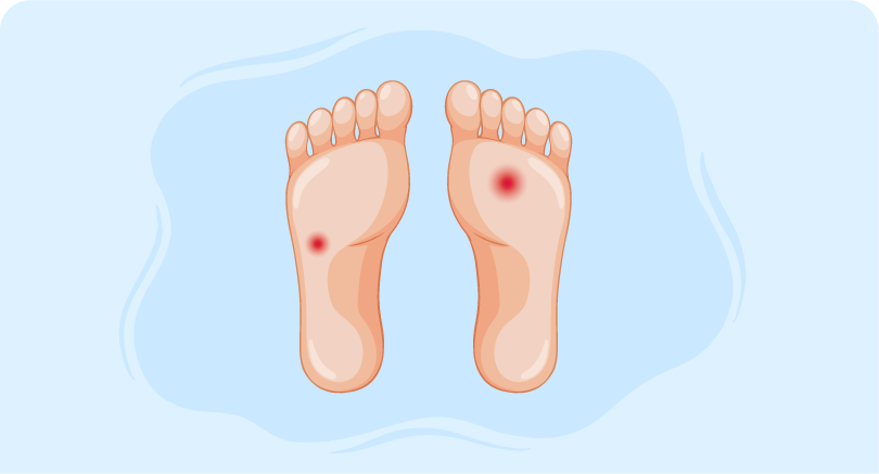 Comprehensive guide to treating neuropathic ulcers