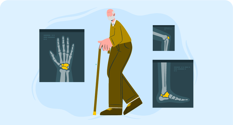 Osteomalacia Management course online