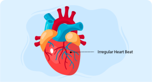 Cardiac Arrest Induction Guide