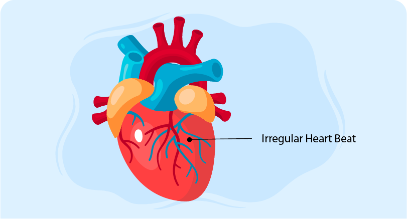 Cardiac Arrest Induction Guide