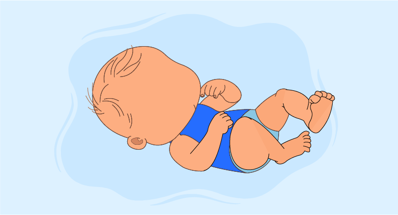 Managing CHILD Syndrome