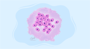 Comprehensive guide to PEComa treatment