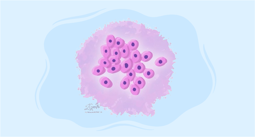 Comprehensive guide to PEComa treatment